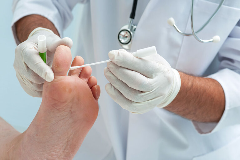 nail fungus remedy
